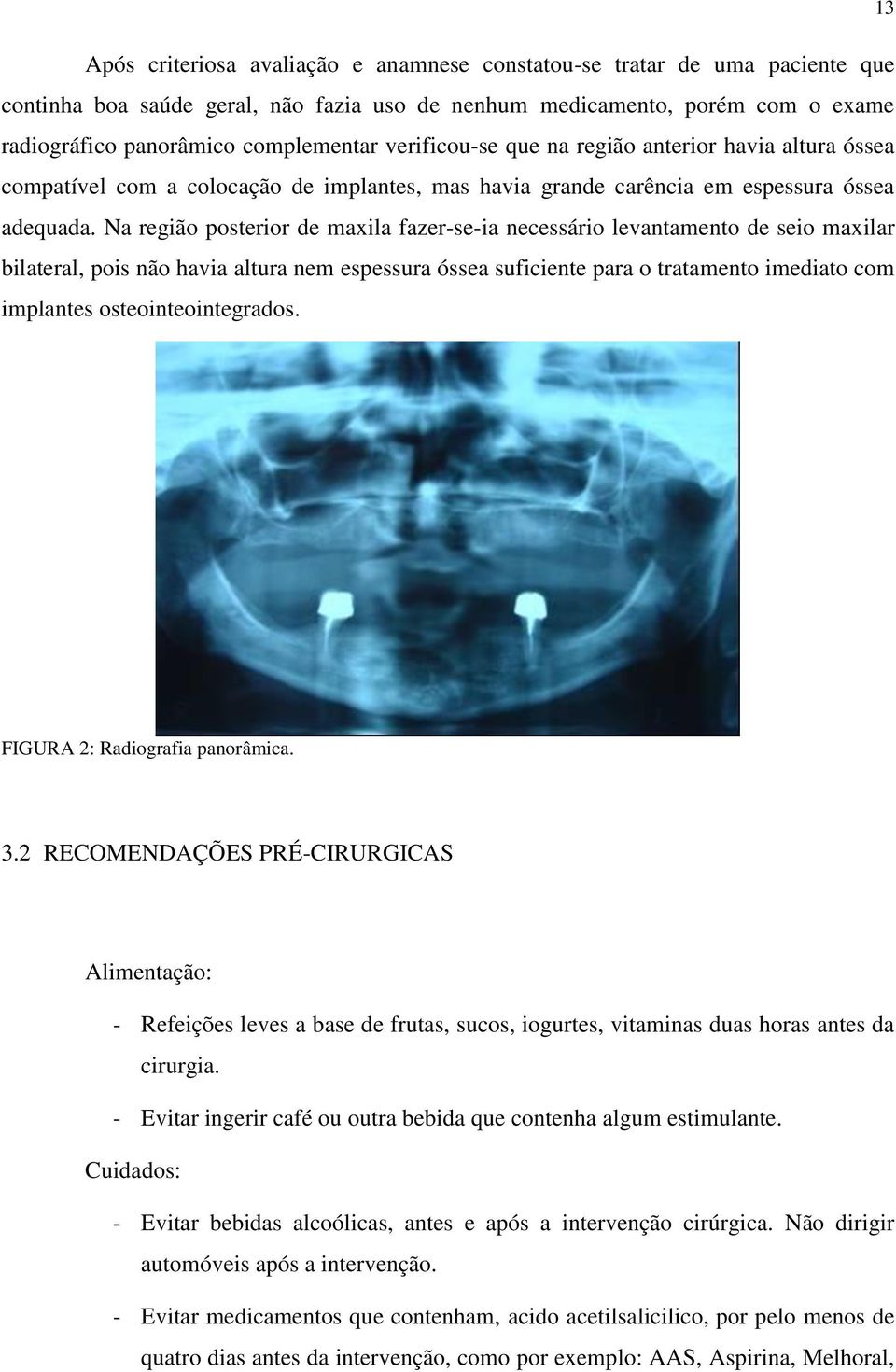 Na região posterior de maxila fazer-se-ia necessário levantamento de seio maxilar bilateral, pois não havia altura nem espessura óssea suficiente para o tratamento imediato com implantes