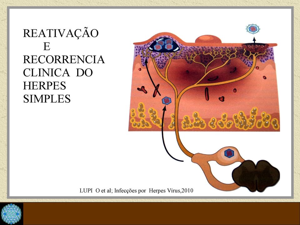 HERPES SIMPLES LUPI O