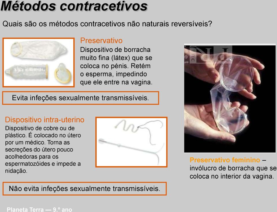 Evita infeções sexualmente transmissíveis. Dispositivo intra-uterino Dispositivo de cobre ou de plástico. É colocado no útero por um médico.