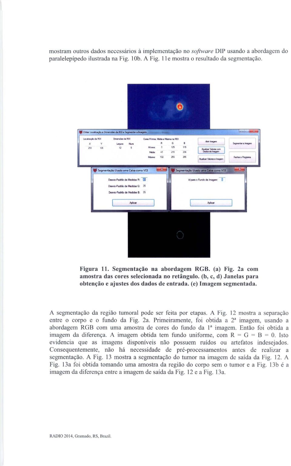 Segmentação na abordagem RGB. (a) Fig. 2a com amostra das cores selecionada no retângulo. (b, c, d) Janelas para obtenção e ajustes dos dados de entrada. (e) Imagem segmentada.