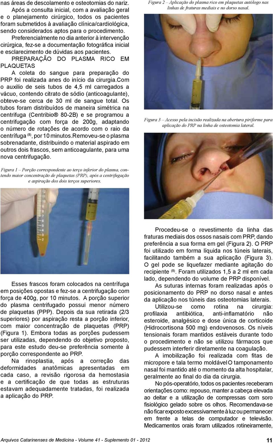 Preferencialmente no dia anterior à intervenção cirúrgica, fez-se a documentação fotográfica inicial e esclarecimento de dúvidas aos pacientes.