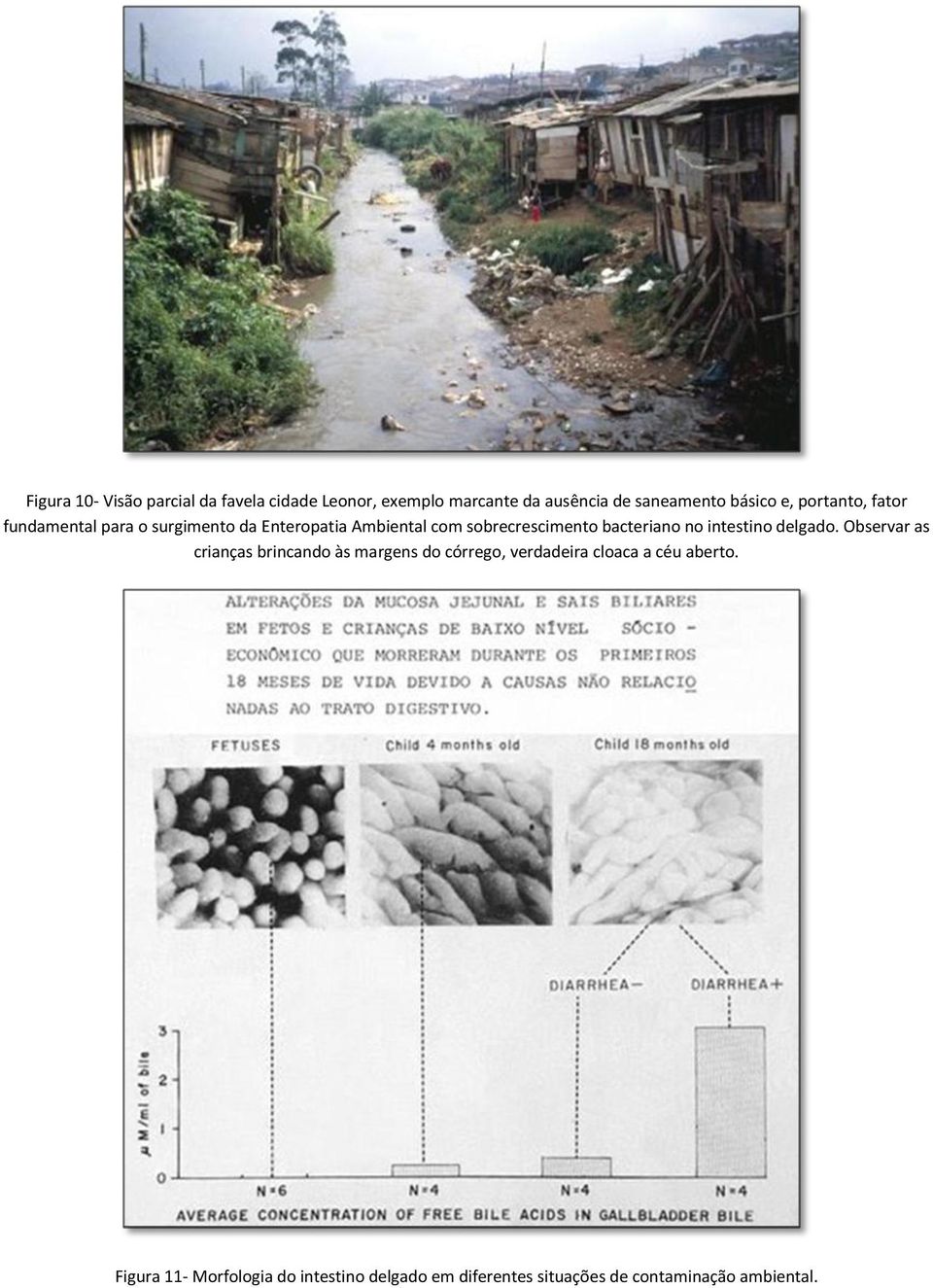 bacteriano no intestino delgado.