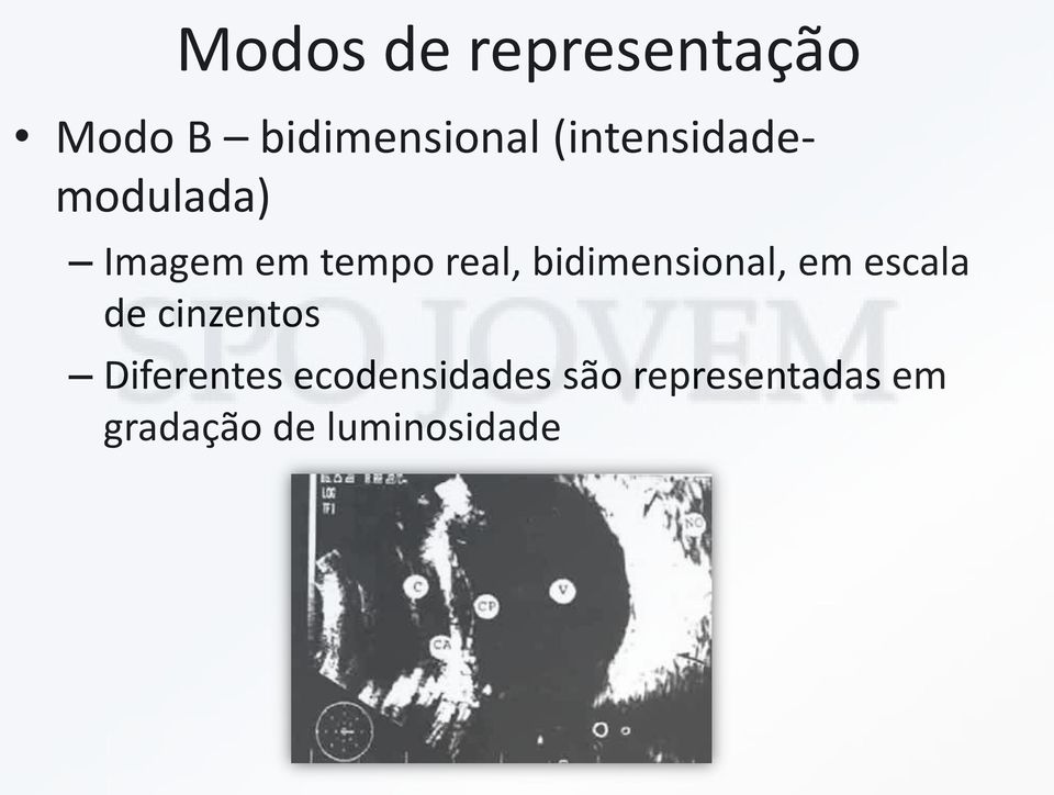 bidimensional, em escala de cinzentos Diferentes