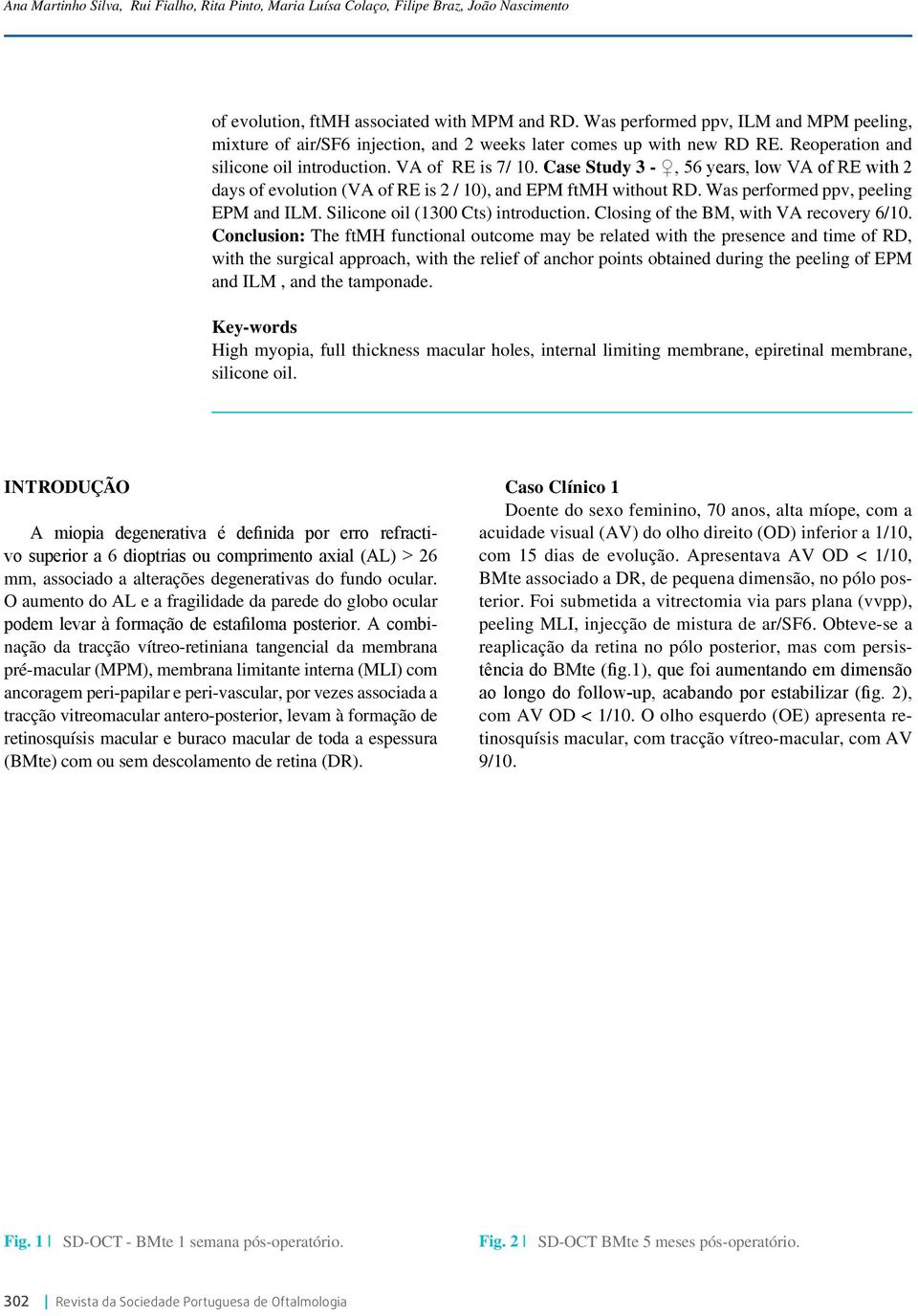 Case Study 3 -, 56 years, low VA of RE with 2 days of evolution (VA of RE is 2 / 10), and EPM ftmh without RD. Was performed ppv, peeling EPM and ILM. Silicone oil (1300 Cts) introduction.