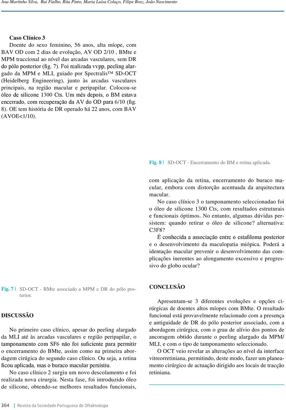 Foi realizada vvpp, peeling alargado da MPM e MLI, guiado por Spectralis SD-OCT (Heidelberg Engineering), junto às arcadas vasculares principais, na região macular e peripapilar.