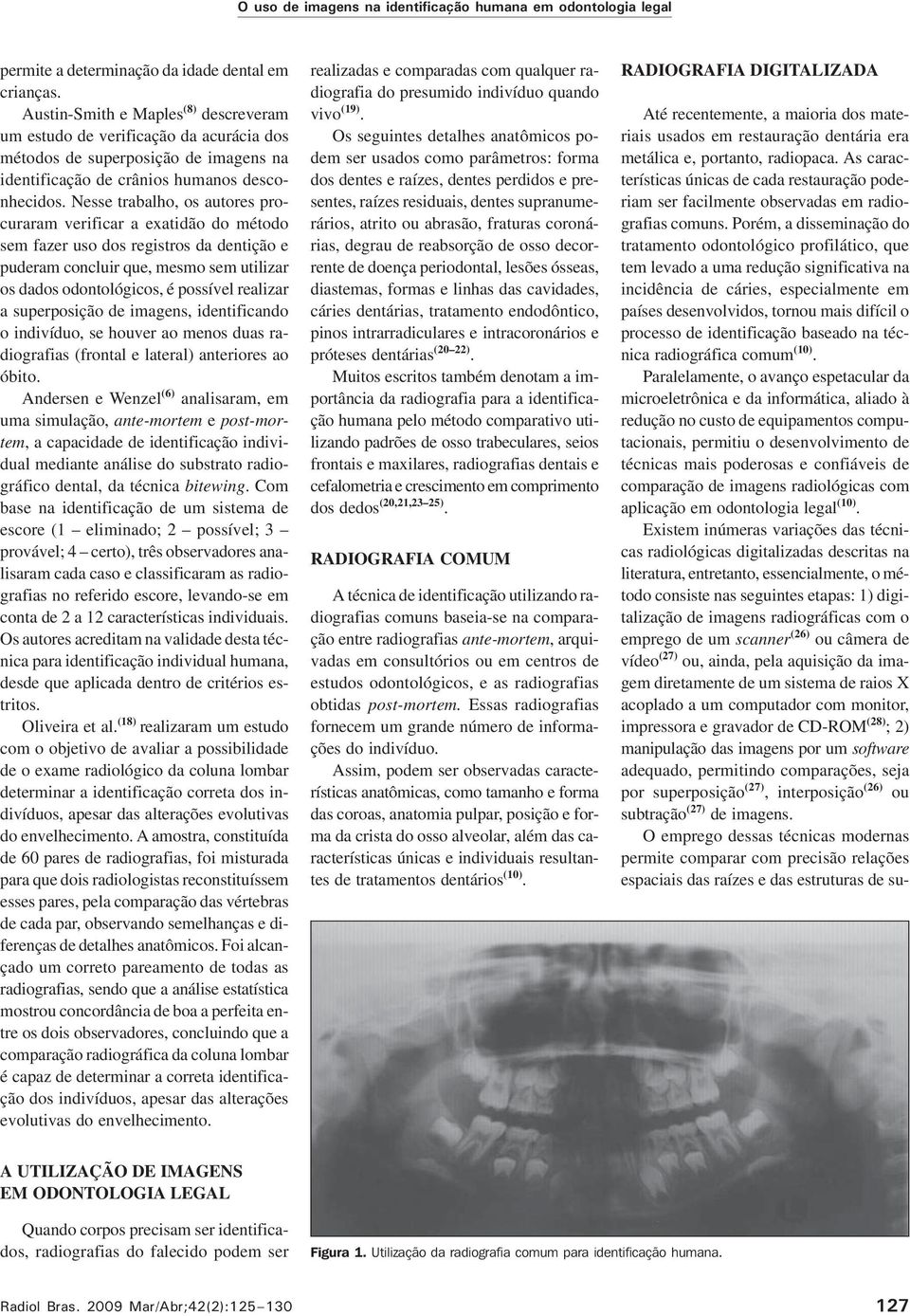 Nesse trabalho, os autores procuraram verificar a exatidão do método sem fazer uso dos registros da dentição e puderam concluir que, mesmo sem utilizar os dados odontológicos, é possível realizar a