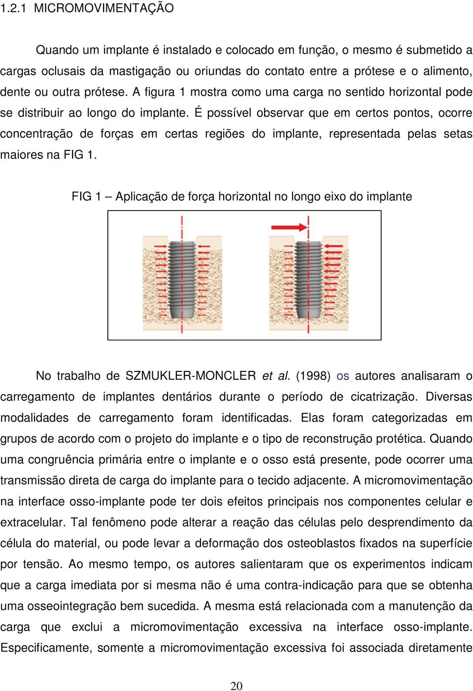 É possível observar que em certos pontos, ocorre concentração de forças em certas regiões do implante, representada pelas setas maiores na FIG 1.