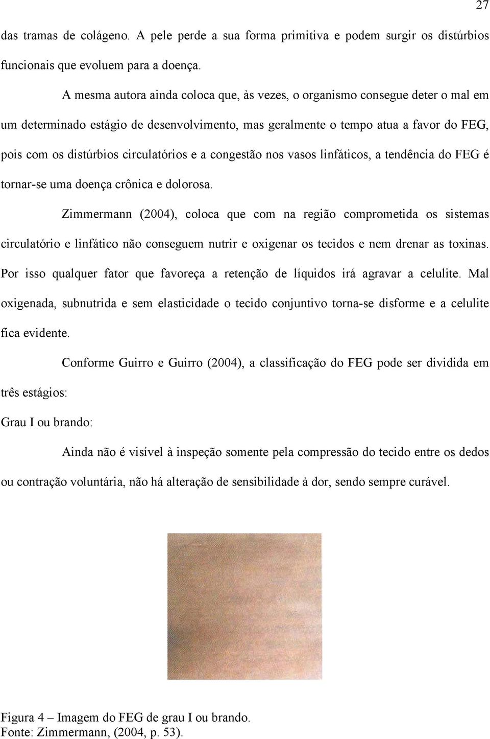 circulatórios e a congestão nos vasos linfáticos, a tendência do FEG é tornar-se uma doença crônica e dolorosa.