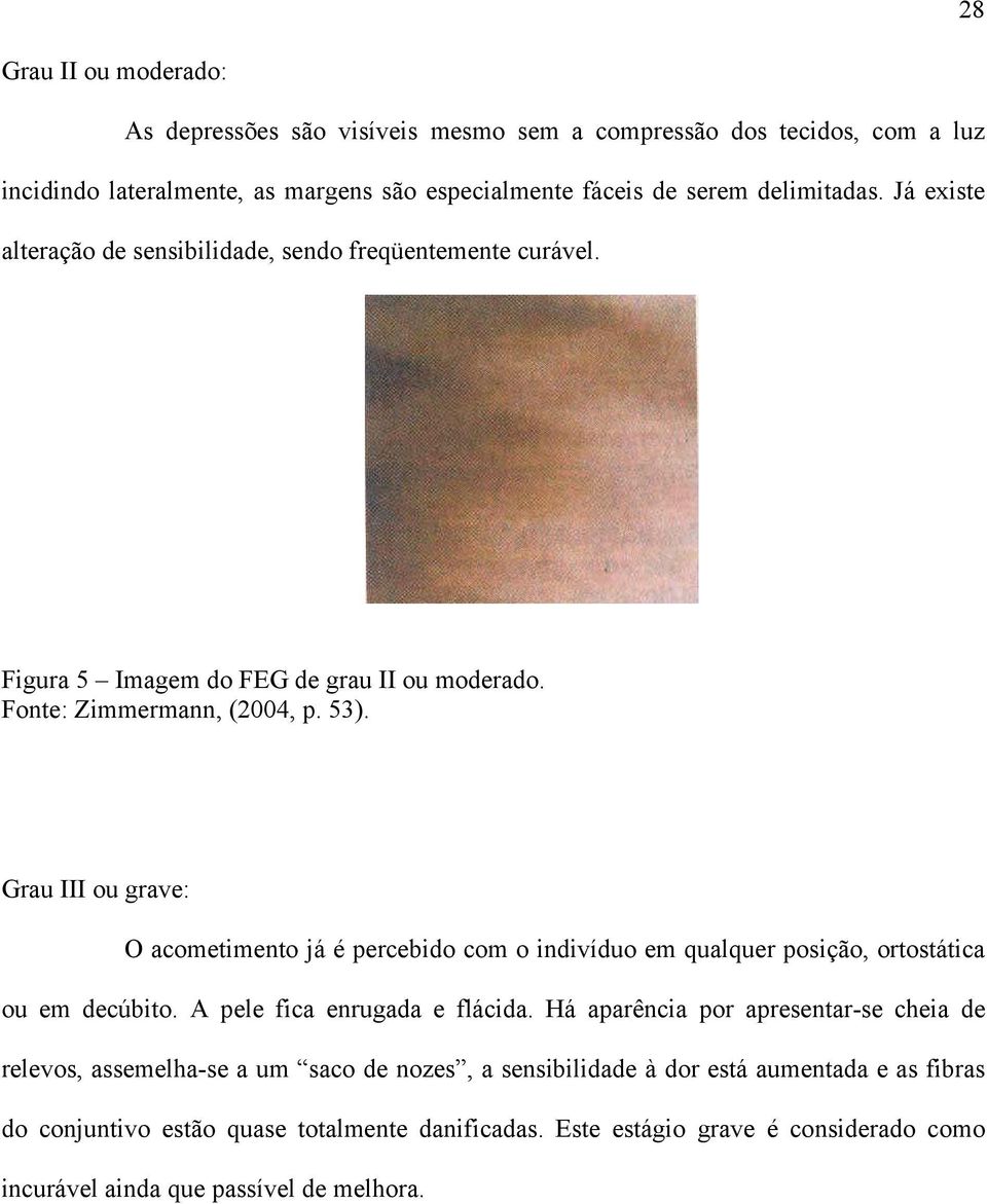 Grau III ou grave: O acometimento já é percebido com o indivíduo em qualquer posição, ortostática ou em decúbito. A pele fica enrugada e flácida.