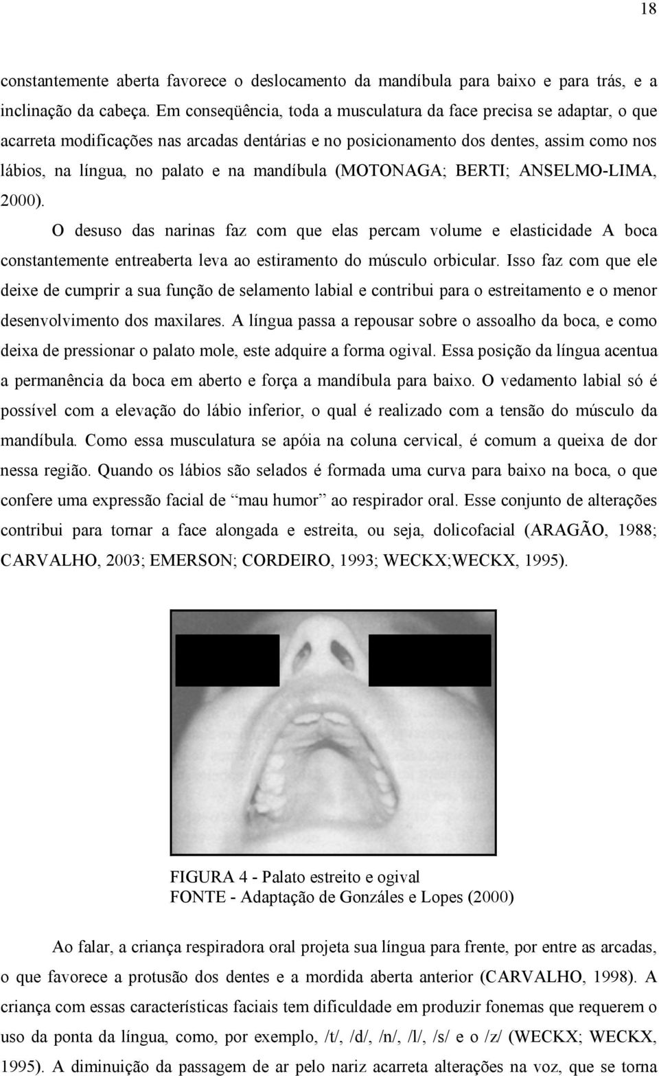 mandíbula (MOTONAGA; BERTI; ANSELMO-LIMA, 2000). O desuso das narinas faz com que elas percam volume e elasticidade A boca constantemente entreaberta leva ao estiramento do músculo orbicular.