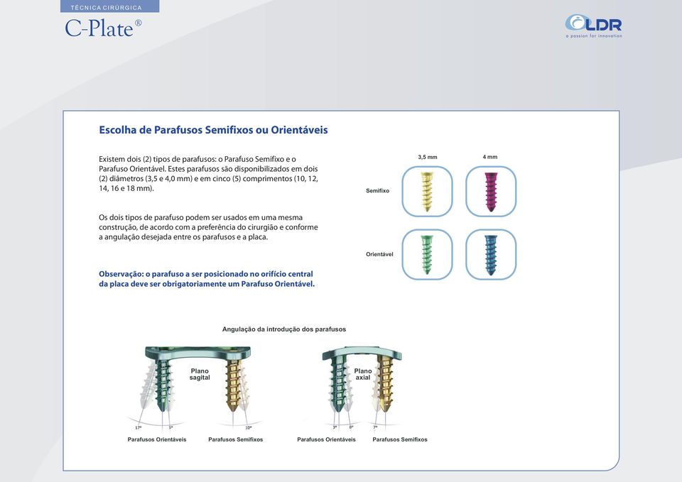Semifixo 3,5 mm 4 mm Os dois tipos de parafuso podem ser usados em uma mesma construção, de acordo com a preferência do cirurgião e conforme a angulação desejada entre os parafusos e a placa.