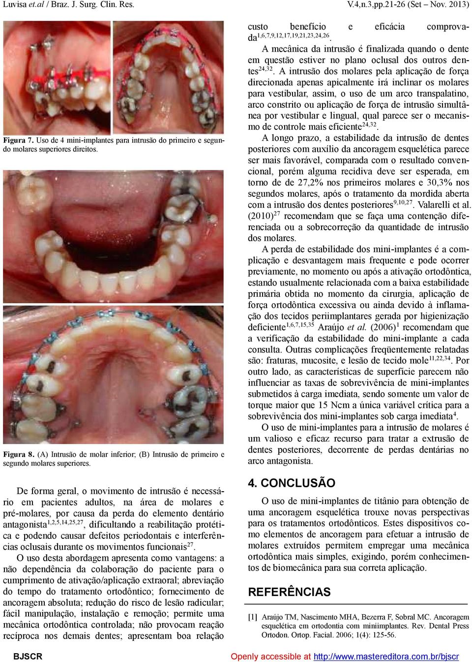 reabilitação protética e podendo causar defeitos periodontais e interferências oclusais durante os movimentos funcionais 27.