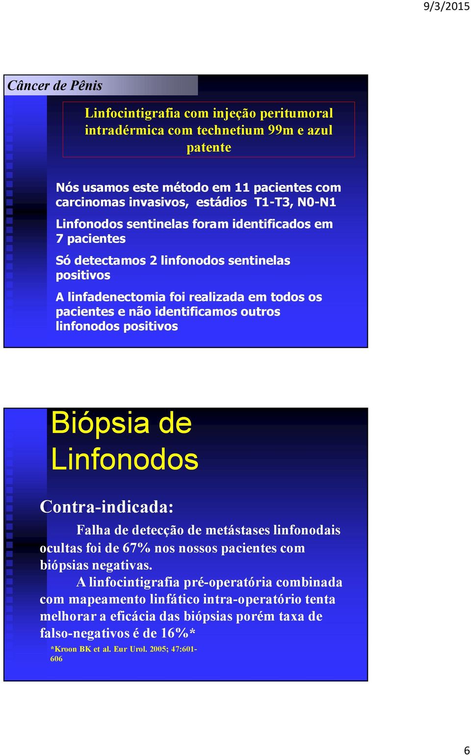 outros linfonodos positivos Biópsia de Linfonodos Contra-indicada: Falha de detecção de metástases linfonodais ocultas foi de 67% nos nossos pacientes com biópsias negativas.