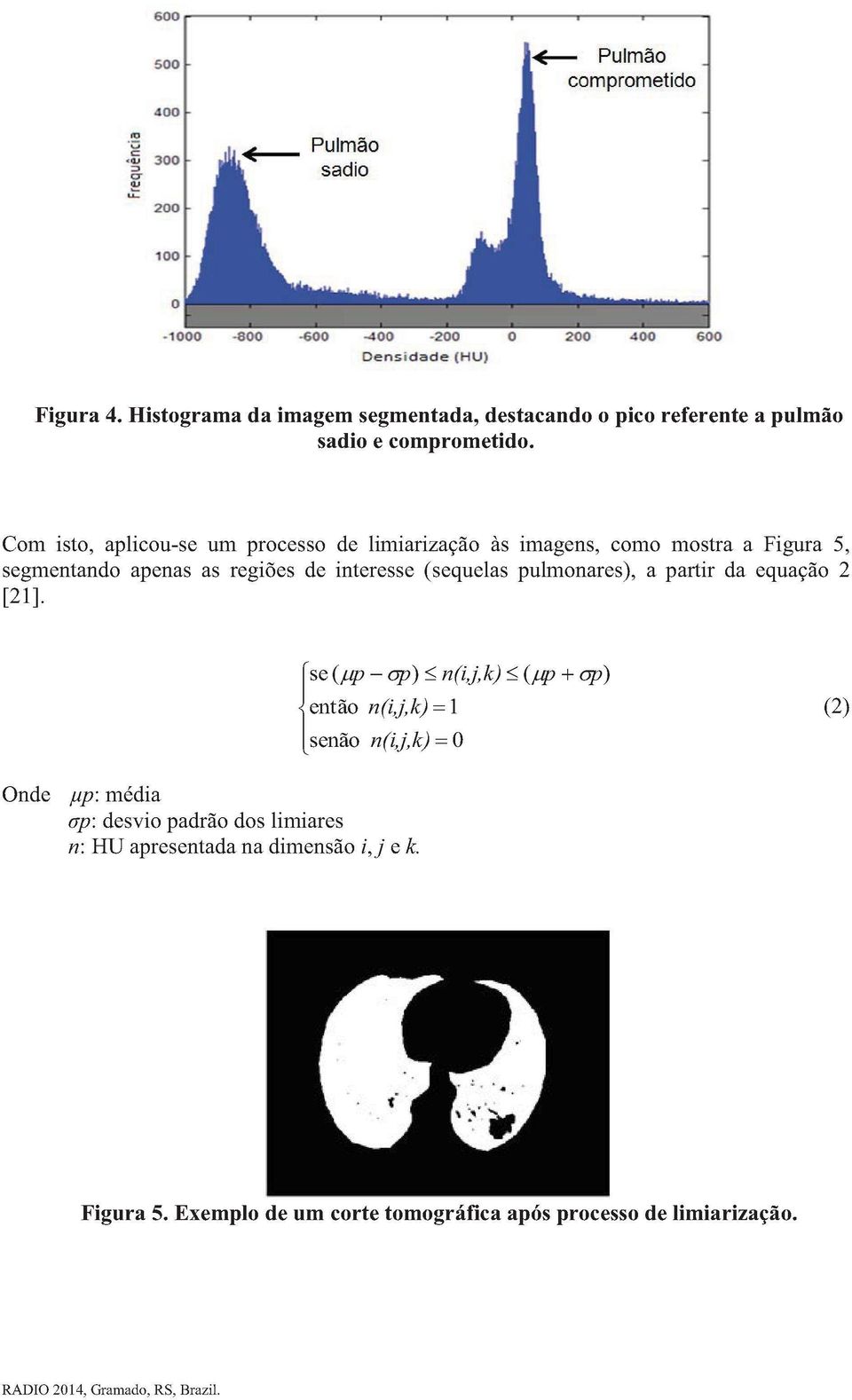 Com isto, aplicou-se um processo de limiarização às imagens, como mostra a Figura 5, segmentando apenas as regiões de interesse (sequelas pulmonares), a