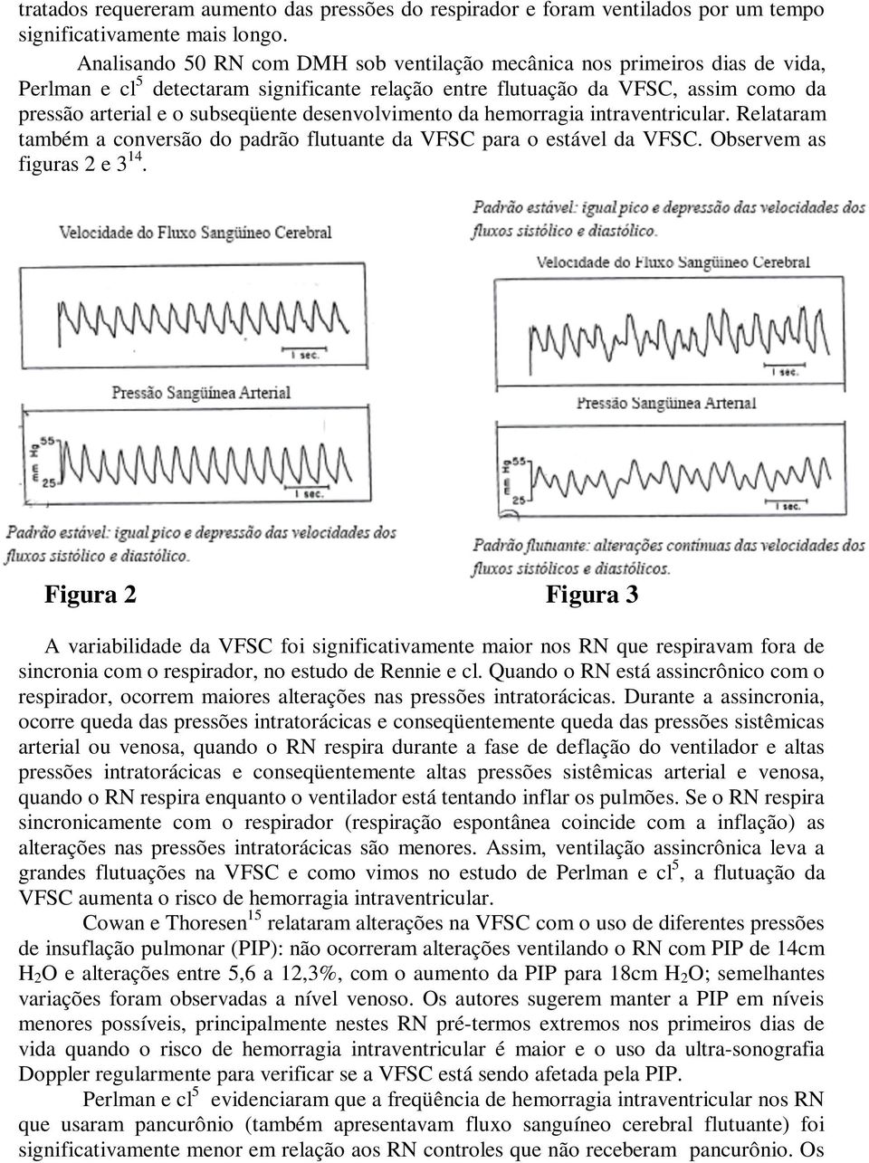 desenvolvimento da hemorragia intraventricular. Relataram também a conversão do padrão flutuante da VFSC para o estável da VFSC. Observem as figuras 2 e 3 14.