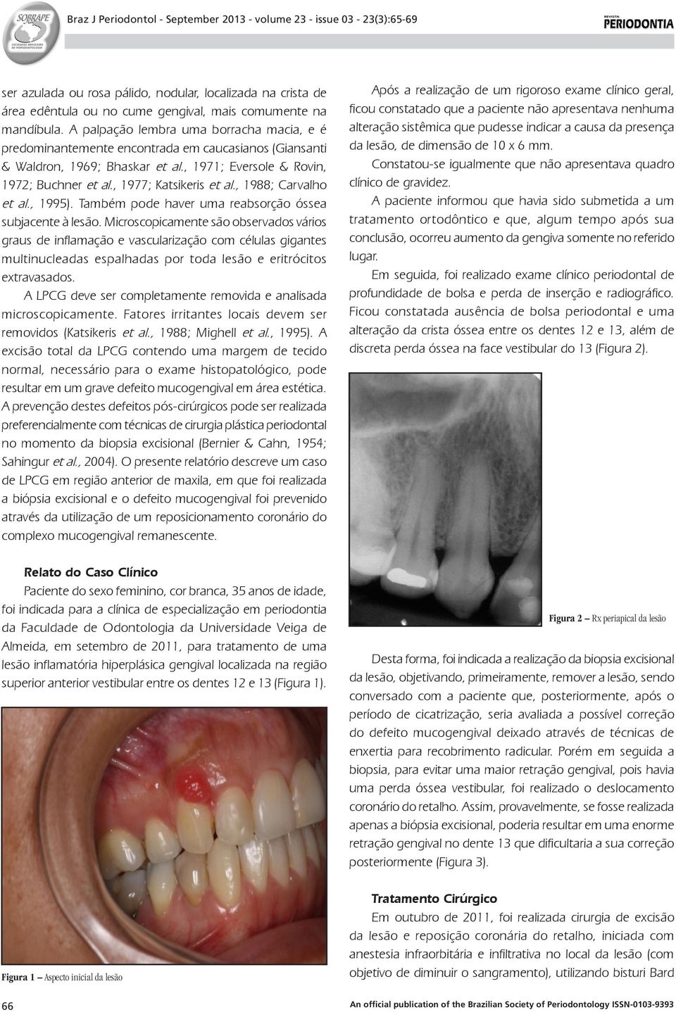 , 1988; Carvalho et al., 1995). Também pode haver uma reabsorção óssea subjacente à lesão.