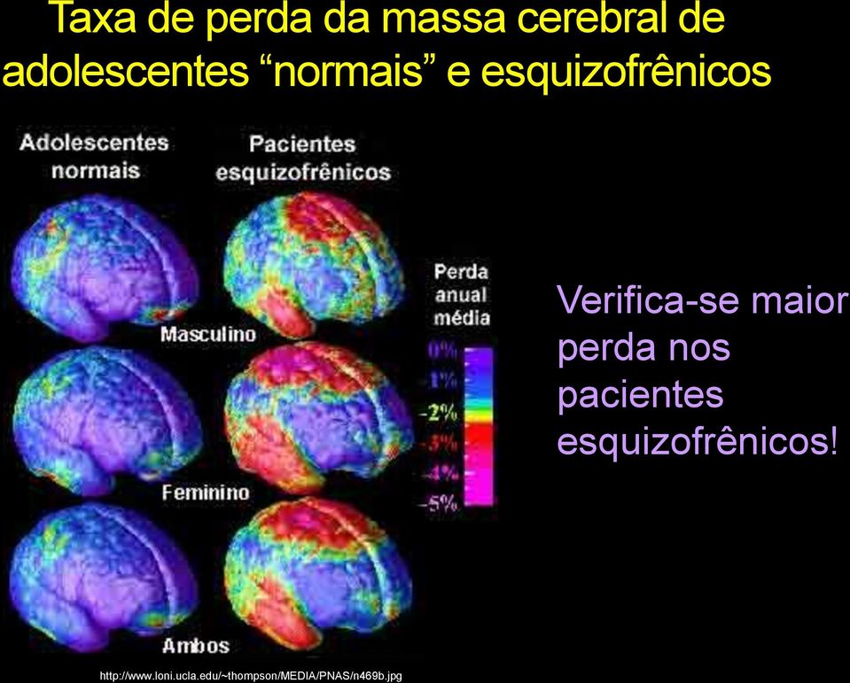 Verifica-se maior perda nos pacientes