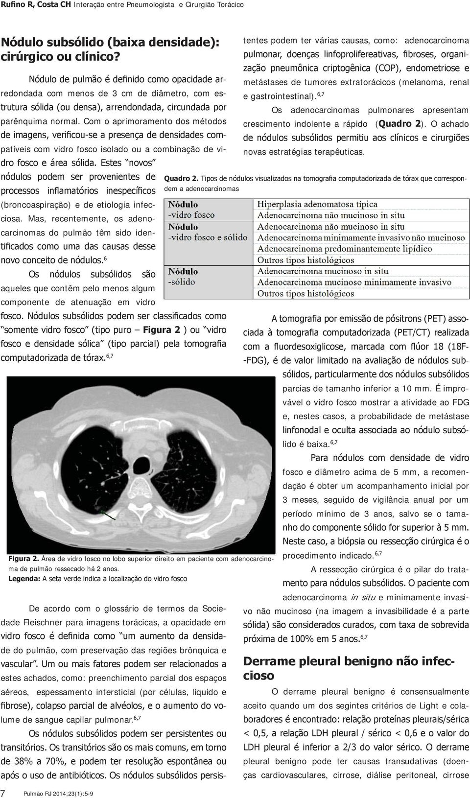 Os adenocarcinomas pulmonares apresentam crescimento indolente a rápido ( ). O achado novas estratégias terapêuticas. dem a adenocarcinomas (broncoaspiração) e de etiologia infecciosa.