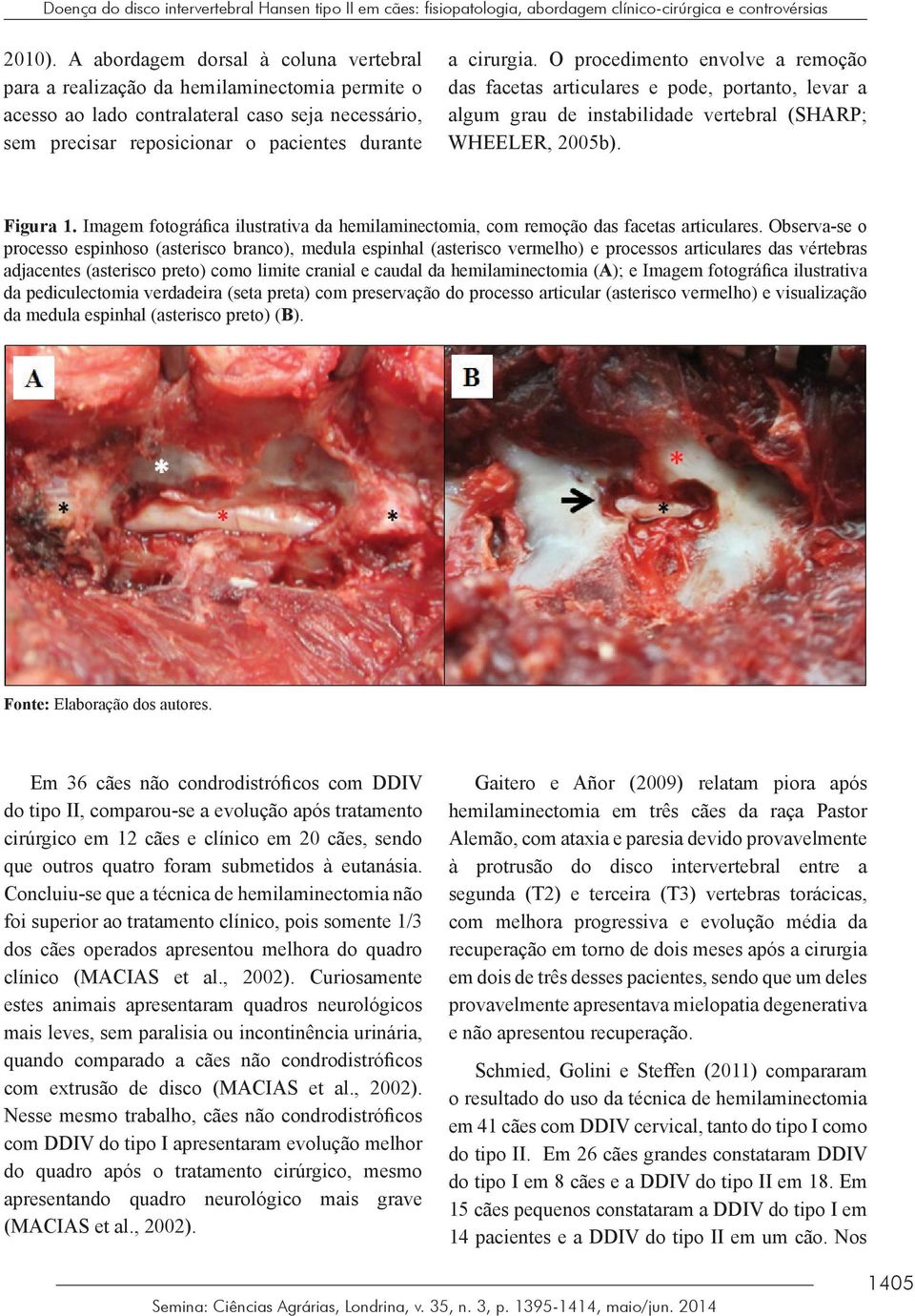 O procedimento envolve a remoção das facetas articulares e pode, portanto, levar a algum grau de instabilidade vertebral (SHARP; WHEELER, 2005b). Figura 1.