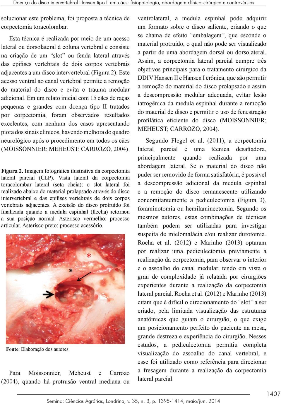 adjacentes a um disco intervertebral (Figura 2). Este acesso ventral ao canal vertebral permite a remoção do material do disco e evita o trauma medular adicional.