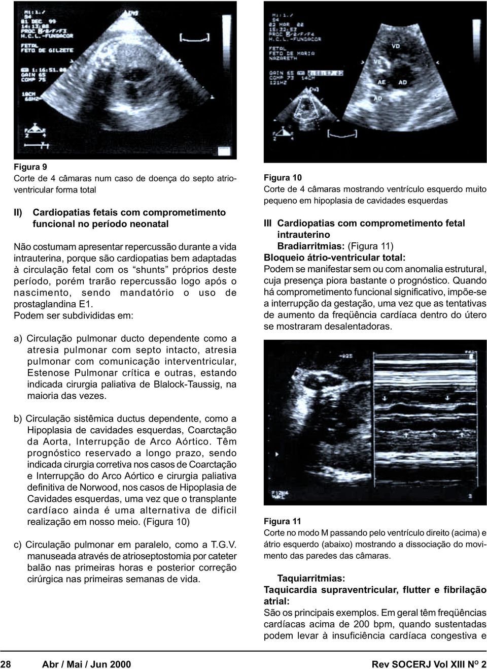 prostaglandina E1.