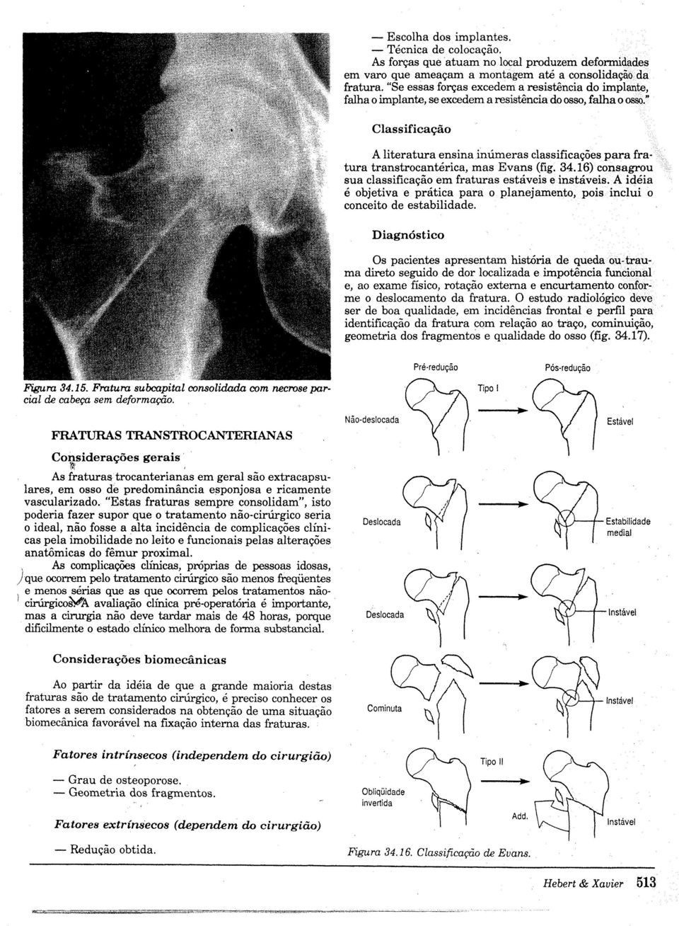 " Classificação A literatura ensinainúmeras classificações para fratura transtrocantérica, mas Evans (fig. 34.16) consagrou sua classifcação em fraturas estáveis e instáveis.