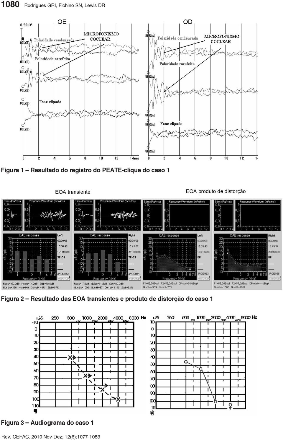 transiente EOA produto de distorção Figura 2 Resultado das