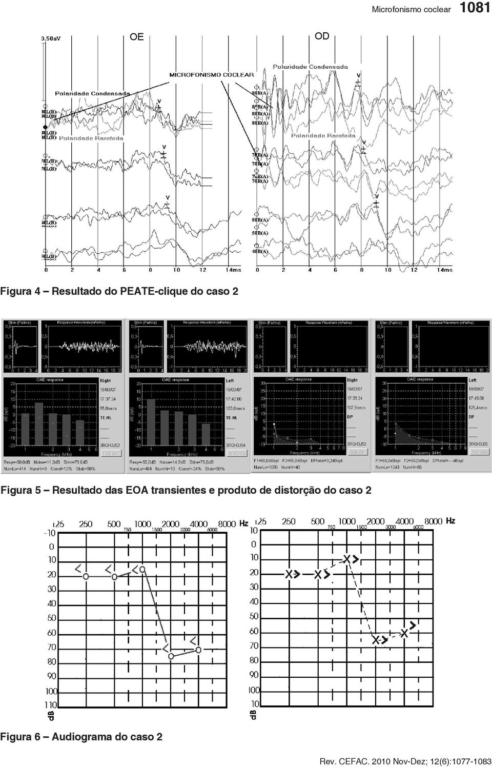 Resultado das EOA transientes e produto de