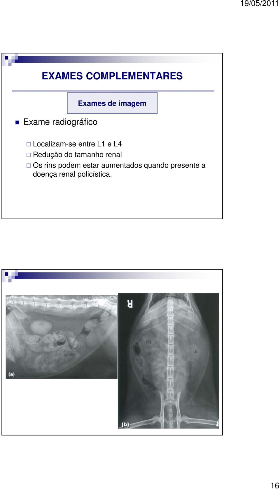 Redução do tamanho renal Os rins podem estar