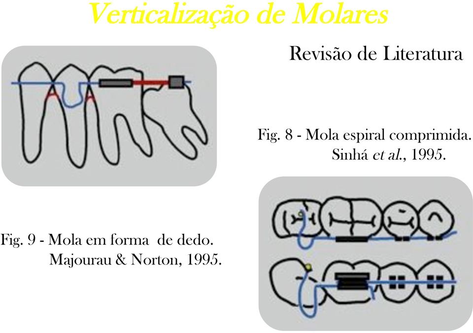 Sinhá et al., 1995. Fig.