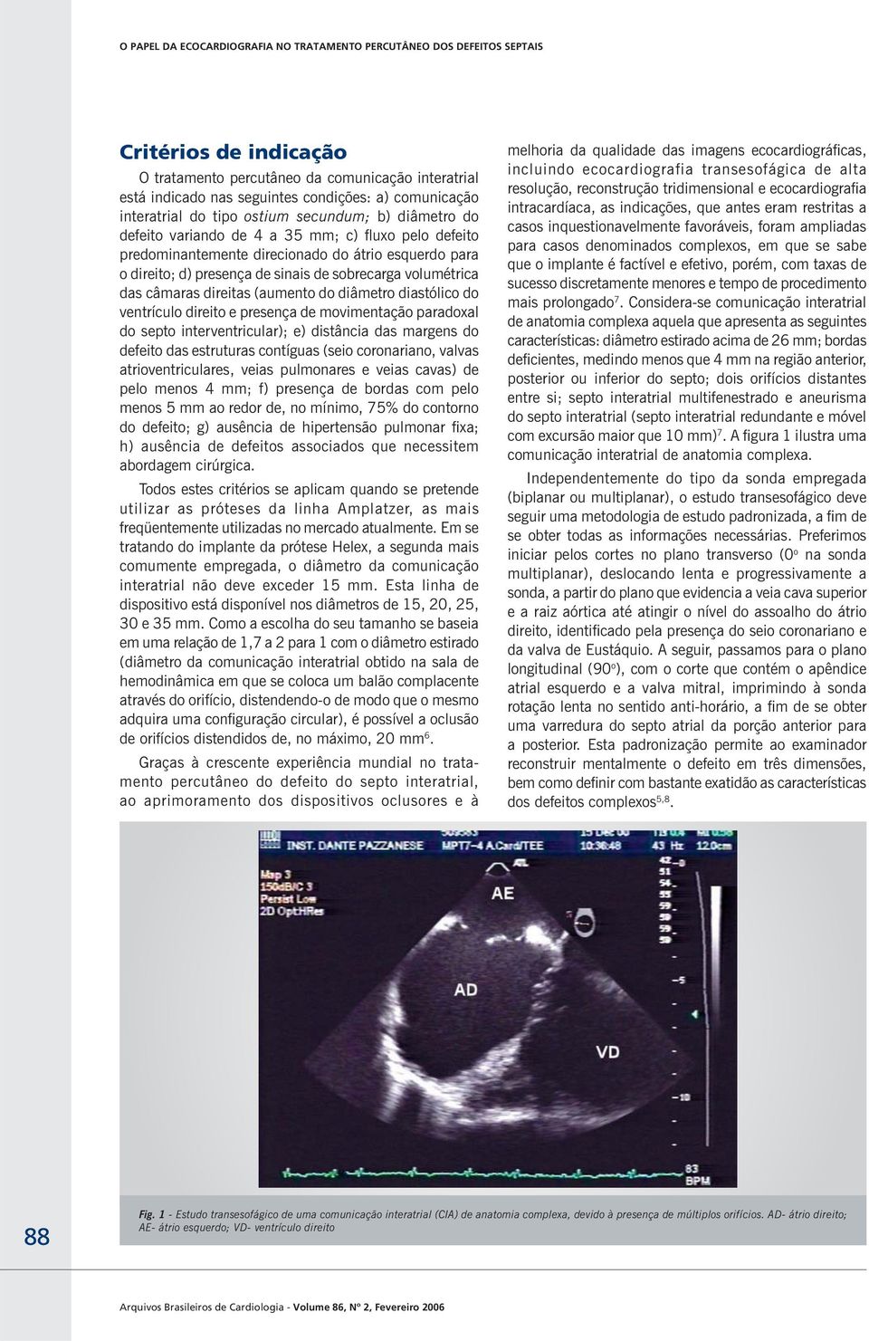 do ventrículo direito e presença de movimentação paradoxal do septo interventricular); e) distância das margens do defeito das estruturas contíguas (seio coronariano, valvas atrioventriculares, veias