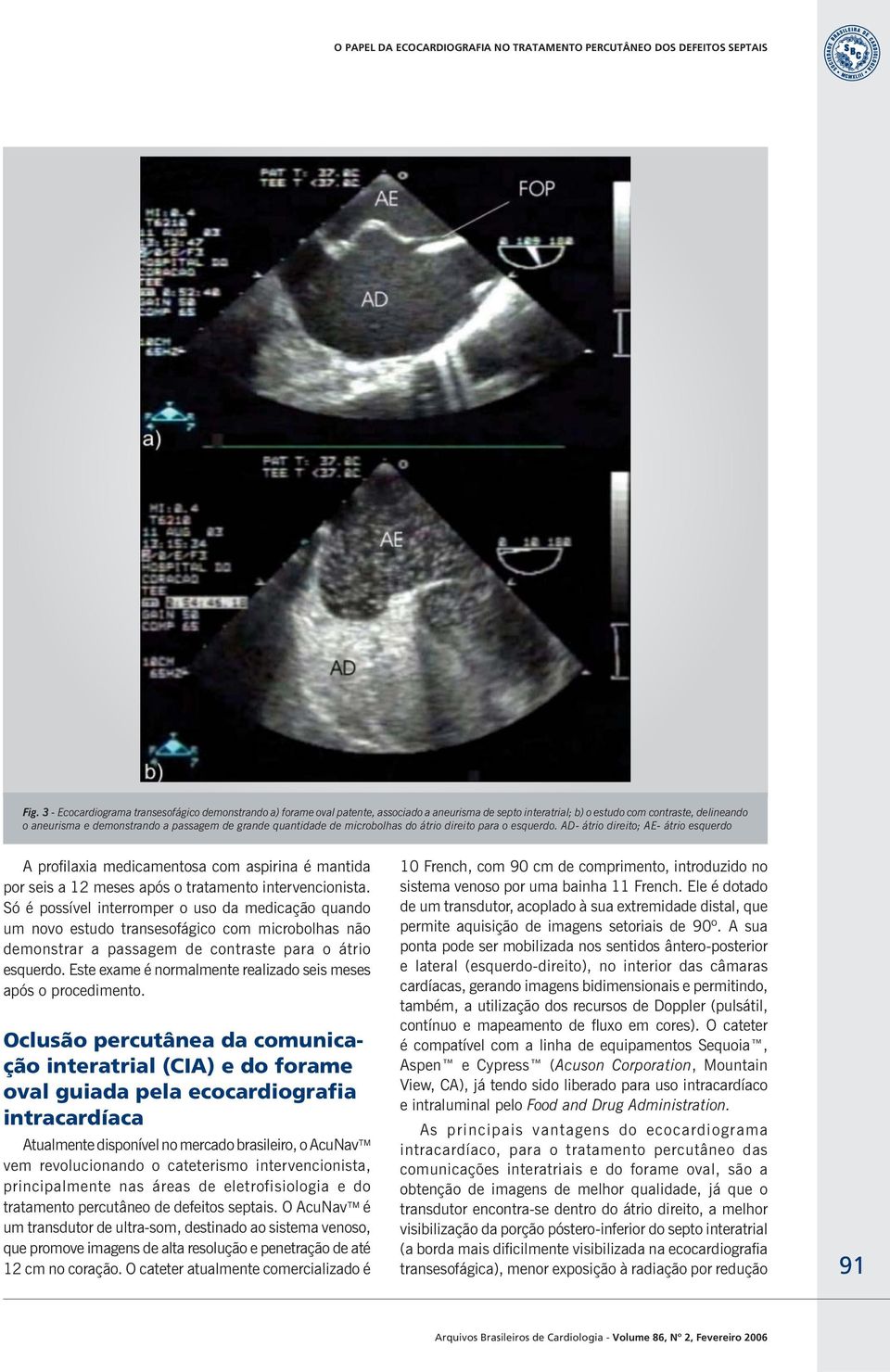 AD- átrio direito; AE- átrio esquerdo A profilaxia medicamentosa com aspirina é mantida por seis a 12 meses após o tratamento intervencionista.