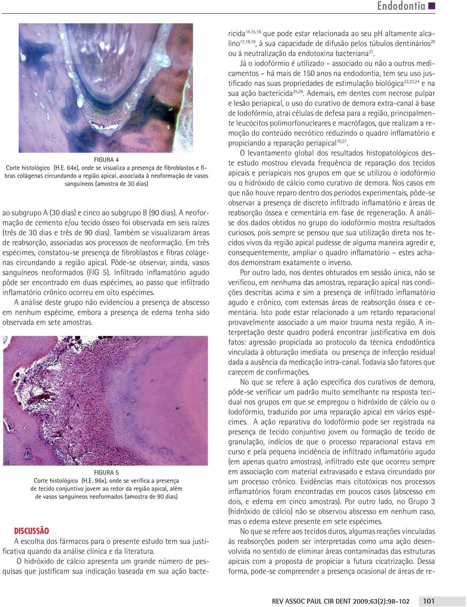 Também se visualizaram áreas de reabsorção, associadas aos processos de neoformação. Em três espécimes, constatou-se presença de fibroblastos e fibras colágenas circundando a região apical.