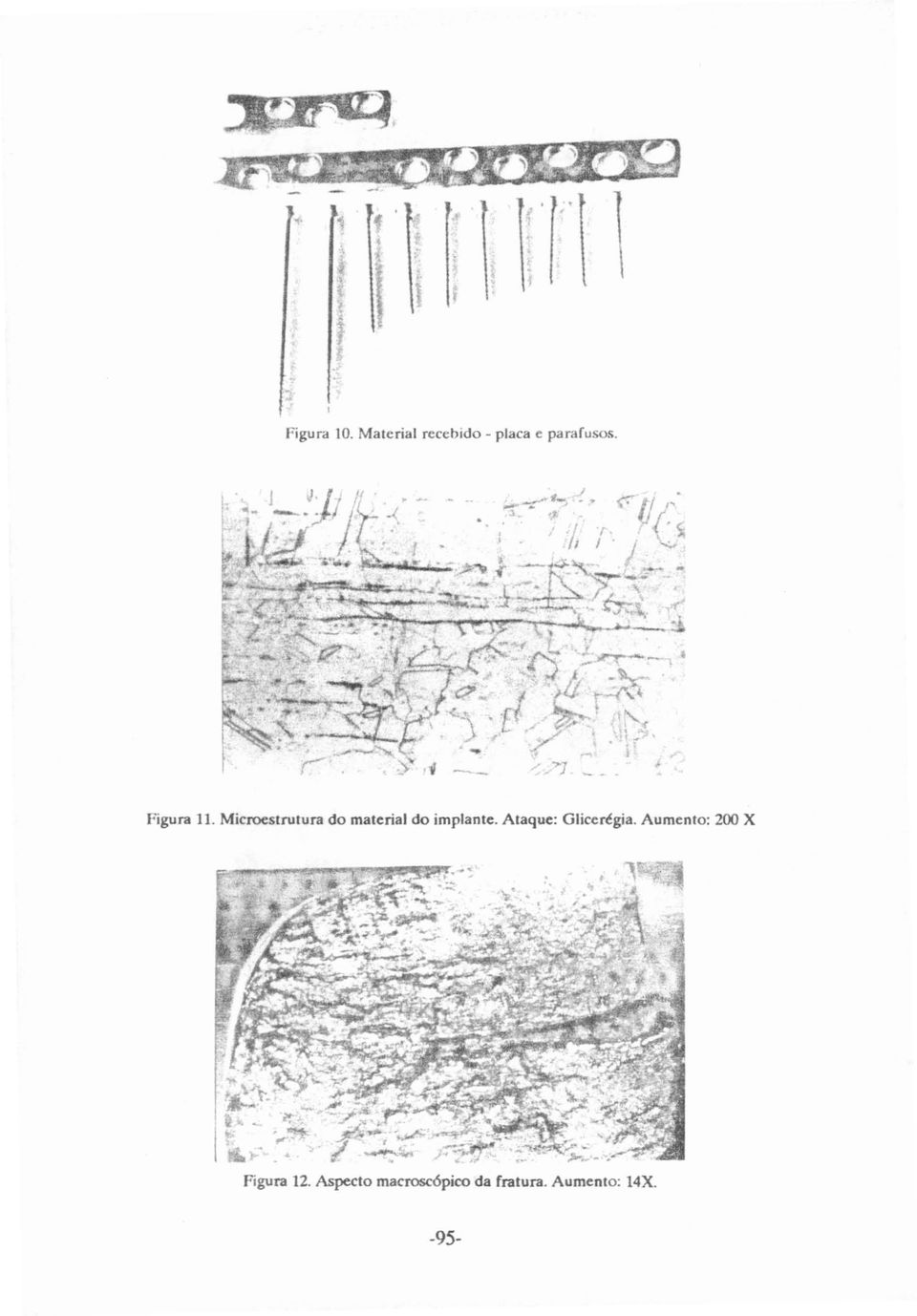 Ataque: Glicerégia. Aumento: 200 X Figura 12.