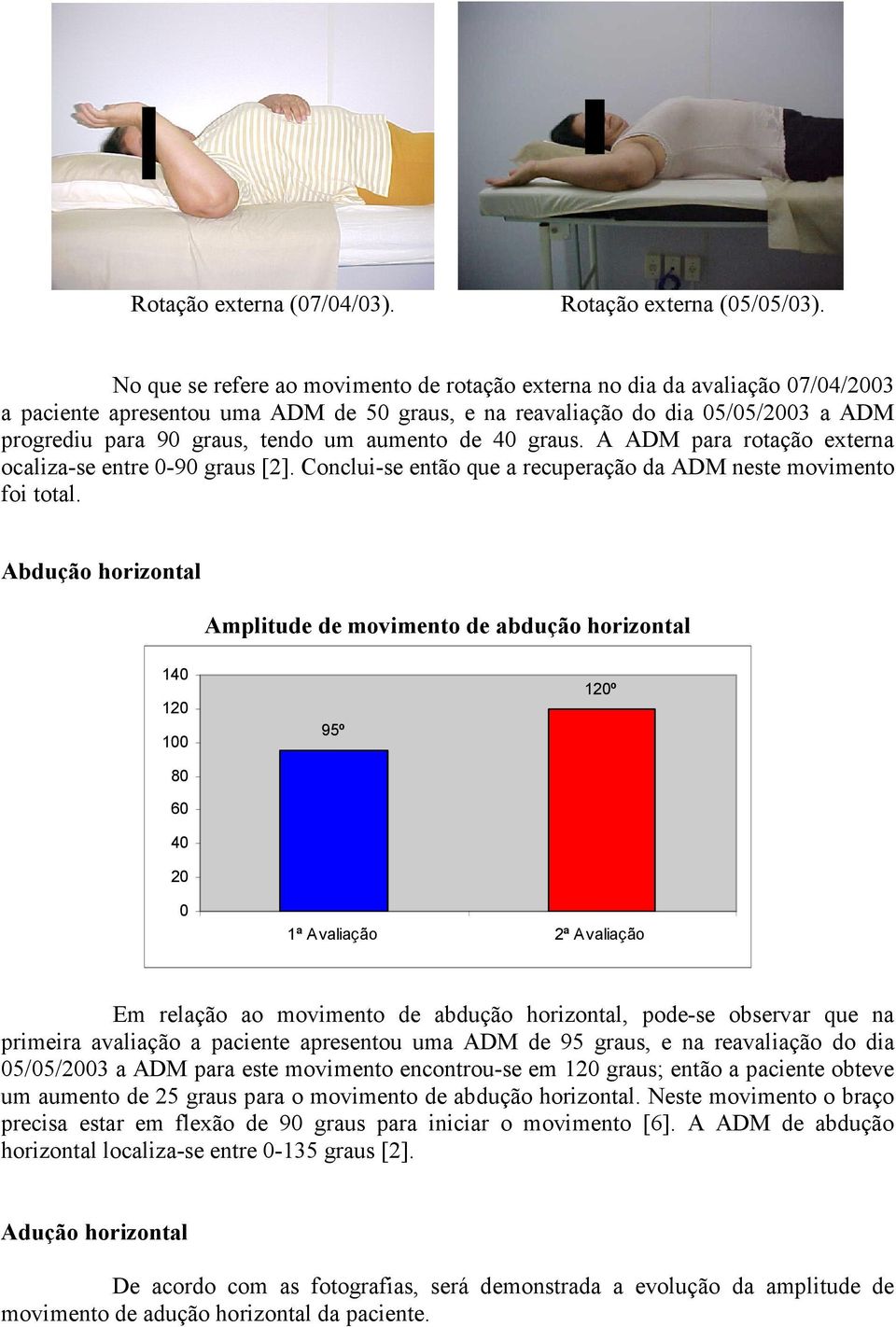 aumento de 40 graus. A ADM para rotação externa ocaliza-se entre 0-90 graus [2]. Conclui-se então que a recuperação da ADM neste movimento foi total.