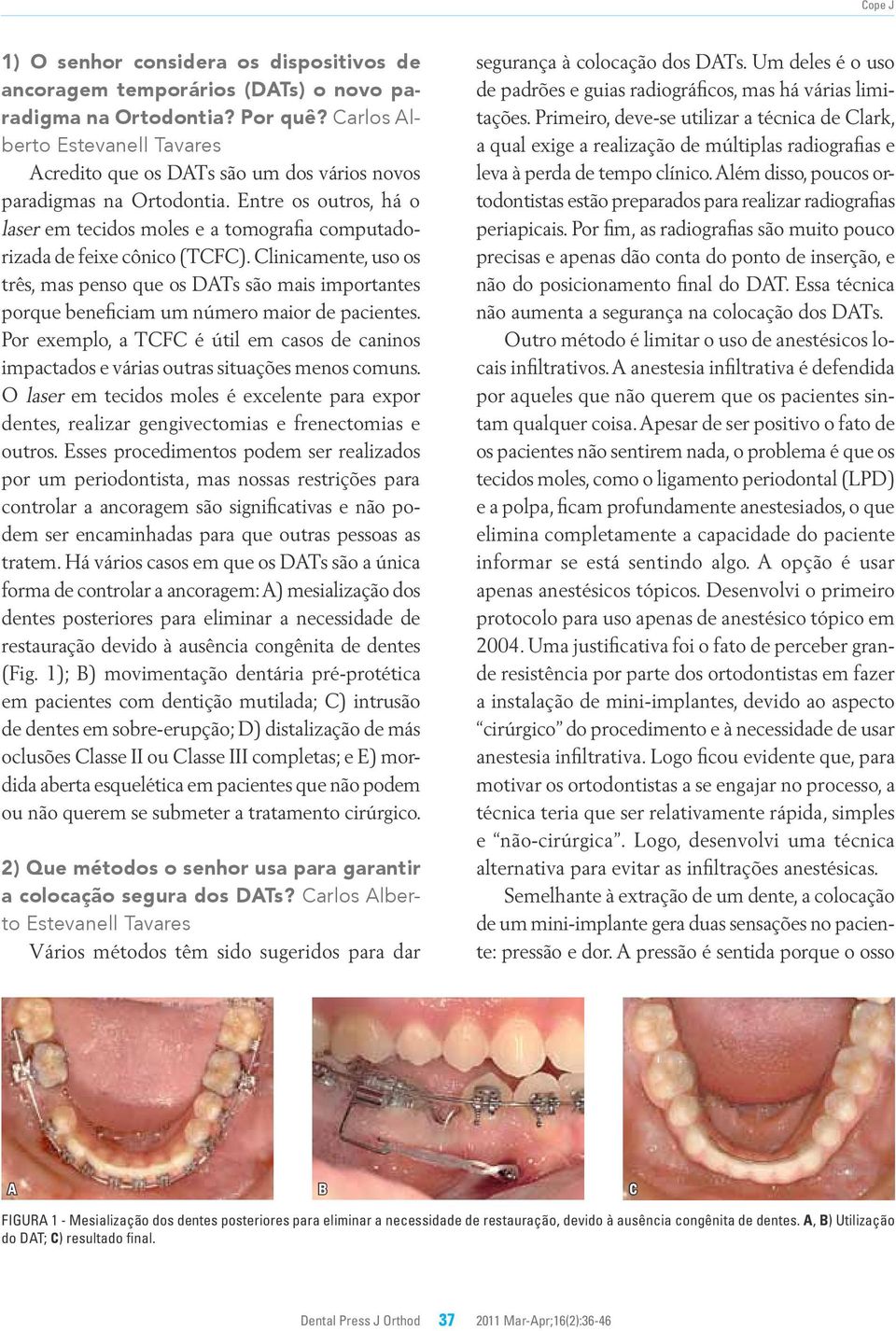 linicamente, uso os três, mas penso que os DTs são mais importantes porque beneficiam um número maior de pacientes.