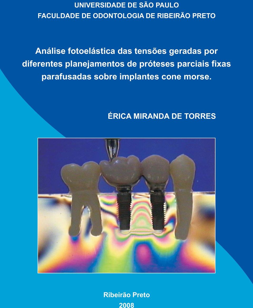 planejamentos de próteses parciais fixas parafusadas sobre