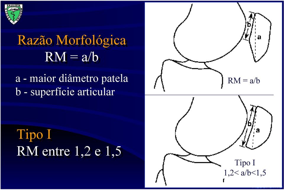 superfície articular RM = a/b