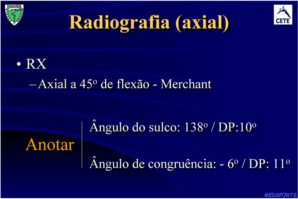 Ângulo do sulco: 138 o / DP:10 o