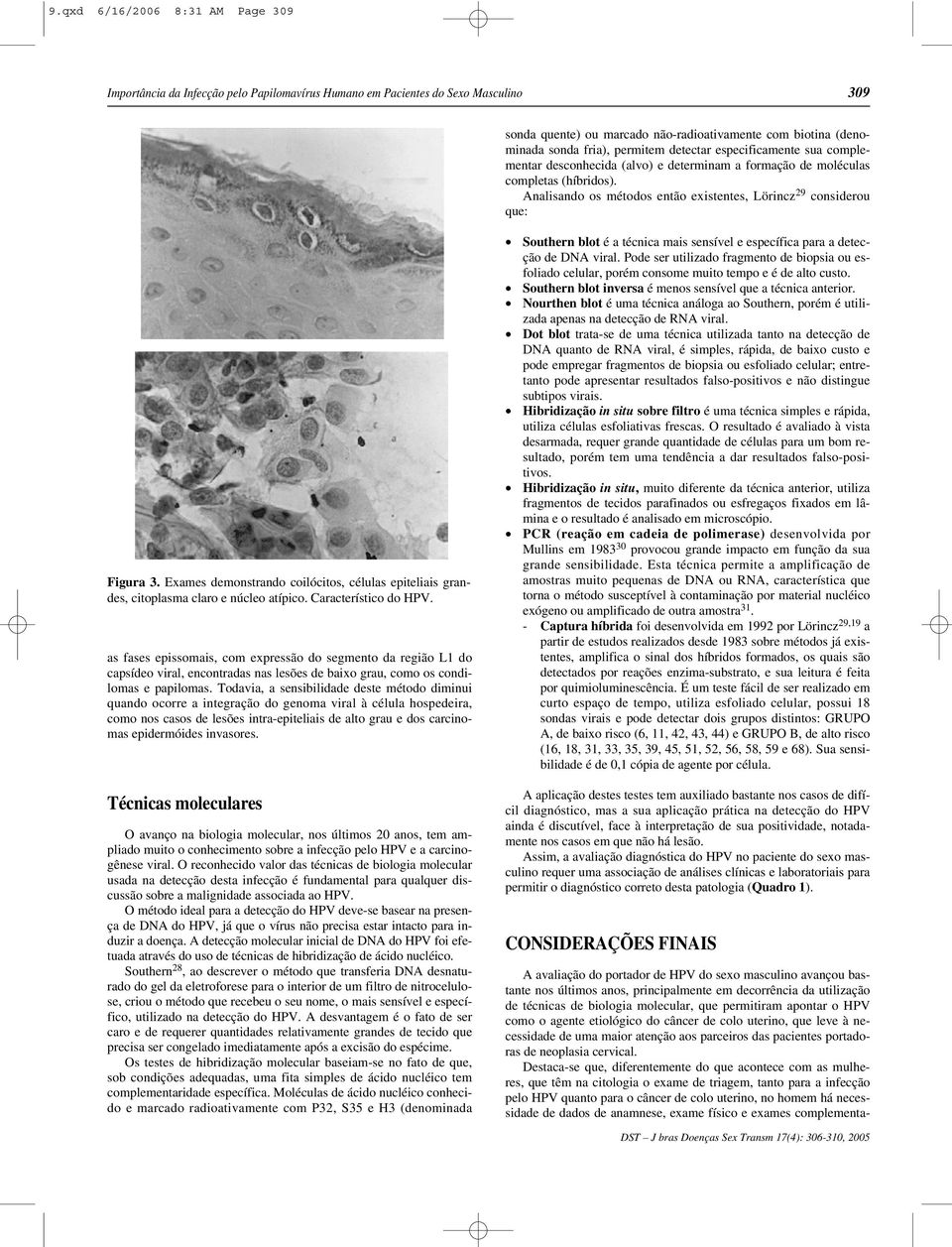 Analisando os métodos então existentes, Lörincz 29 considerou que: Figura 3. Exames demonstrando coilócitos, células epiteliais grandes, citoplasma claro e núcleo atípico. Característico do HPV.