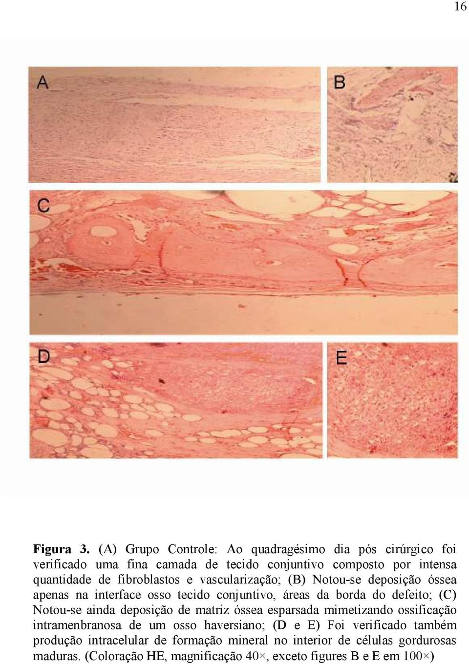 fibroblastos e vascularização; (B) Notou-se deposição óssea apenas na interface osso tecido conjuntivo, áreas da borda do defeito; (C) Notou-se