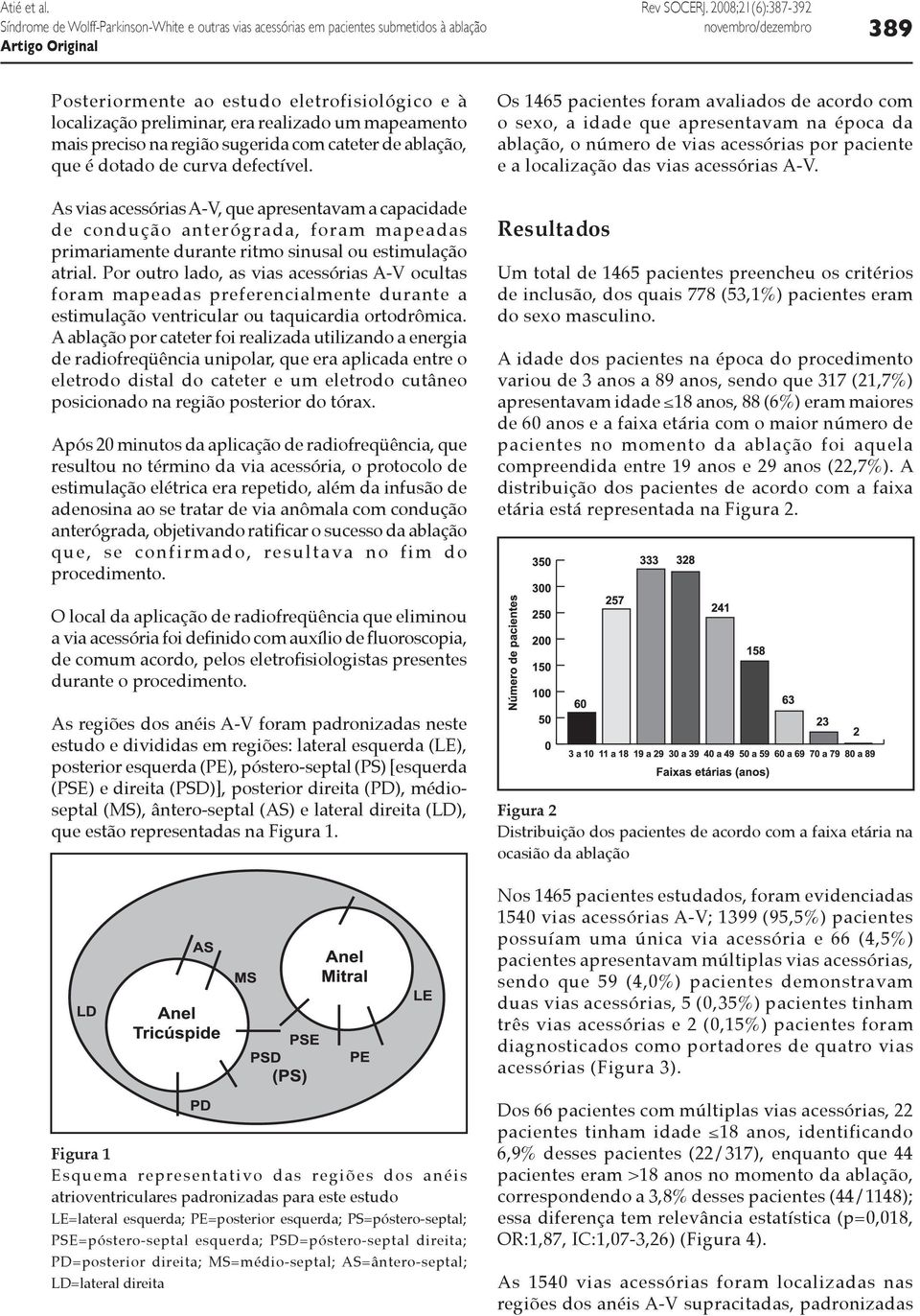 As vias acessórias A-V, que apresentavam a capacidade de condução anterógrada, foram mapeadas primariamente durante ritmo sinusal ou estimulação atrial.