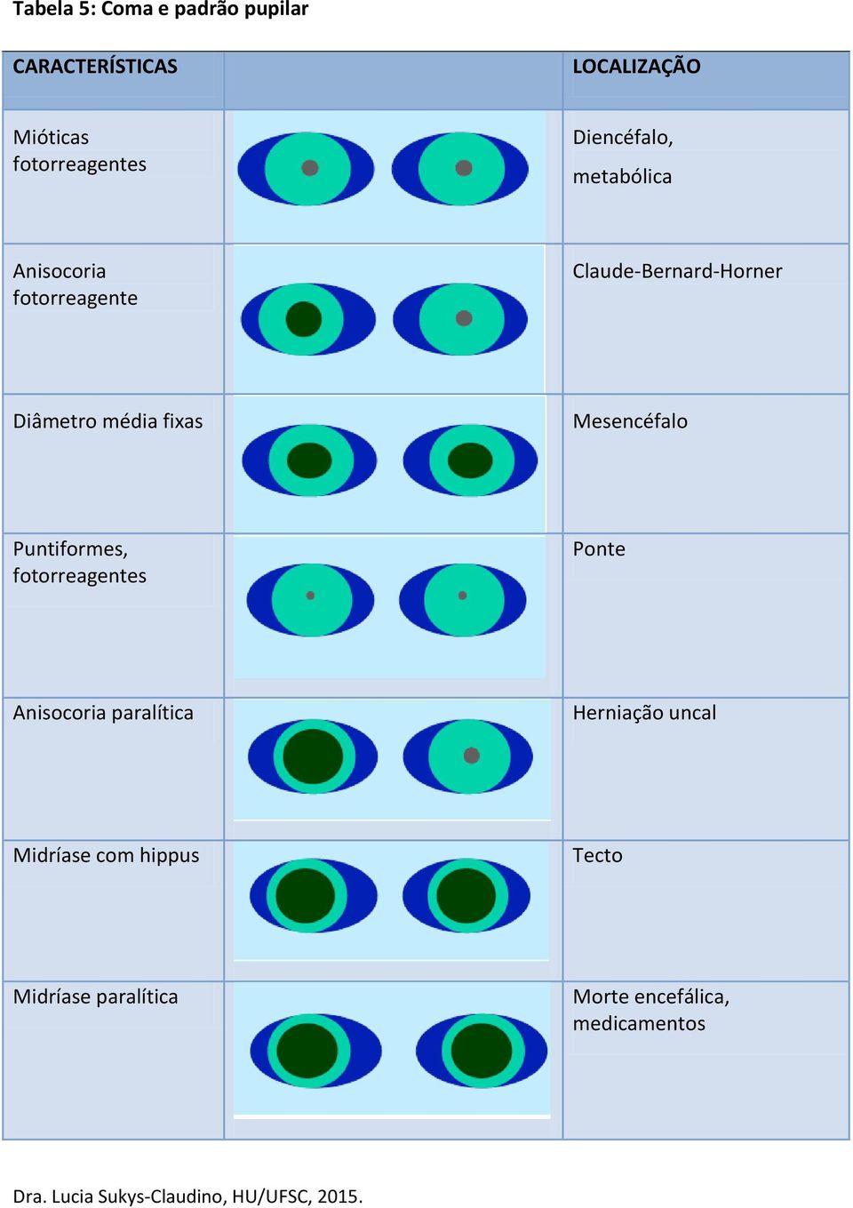 média fixas Mesencéfalo Puntiformes, fotorreagentes Ponte Anisocoria paralítica