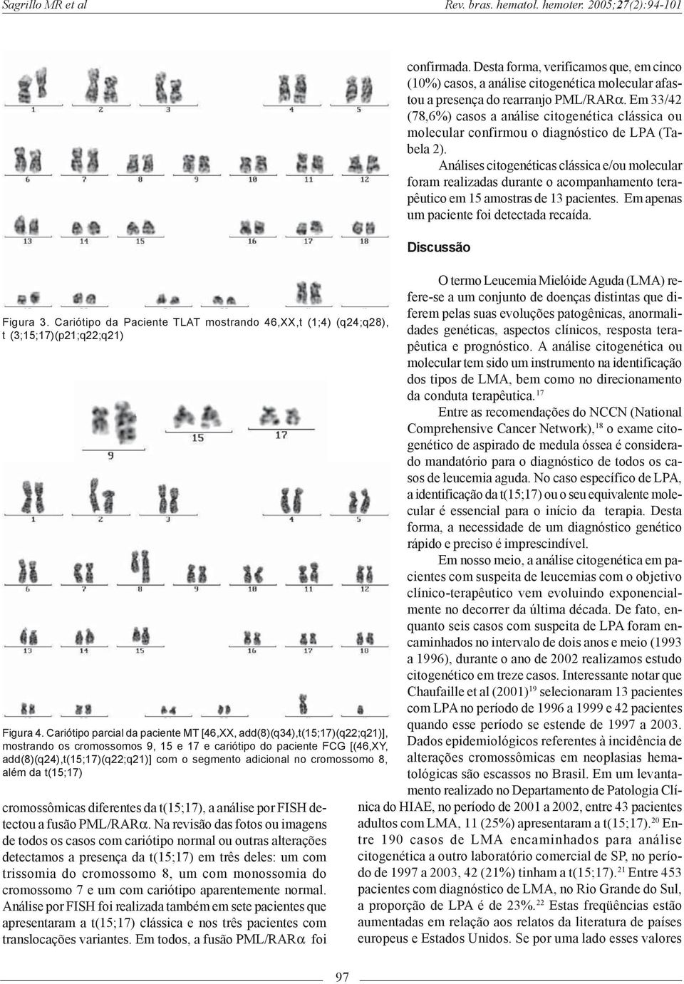 adicional no cromossomo 8, além da t(15;17) cromossômicas diferentes da t(15;17), a análise por FISH detectou a fusão PML/RARα.