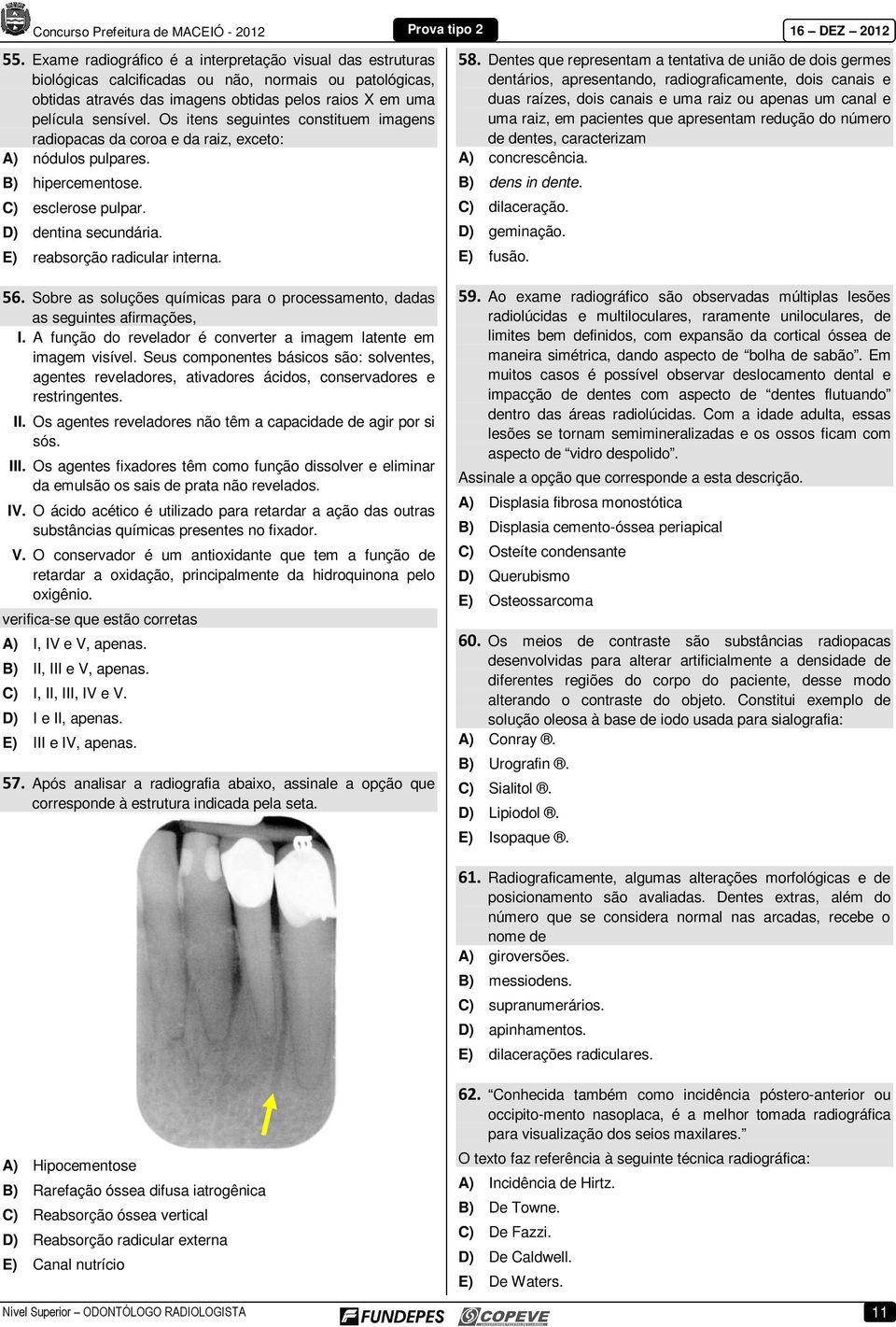 Sobre as soluções químicas para o processamento, dadas as seguintes afirmações, I. A função do revelador é converter a imagem latente em imagem visível.