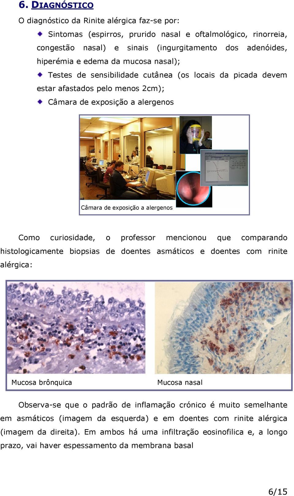 professor mencionou que comparando histologicamente biopsias de doentes asmáticos e doentes com rinite alérgica: Mucosa brônquica Mucosa nasal Observa-se que o padrão de inflamação crónico é muito