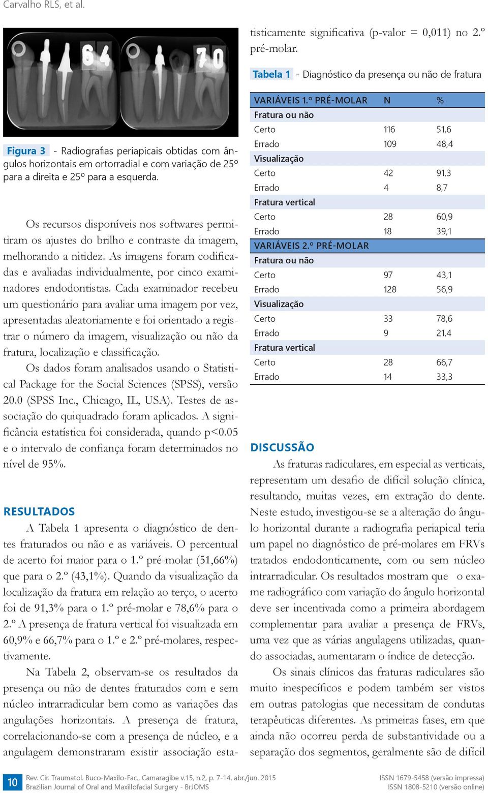 º A presença de fratura vertical foi visualizada em 60,9% e 66,7% para o 1.º e 2.º pré-molares, respectivamente.