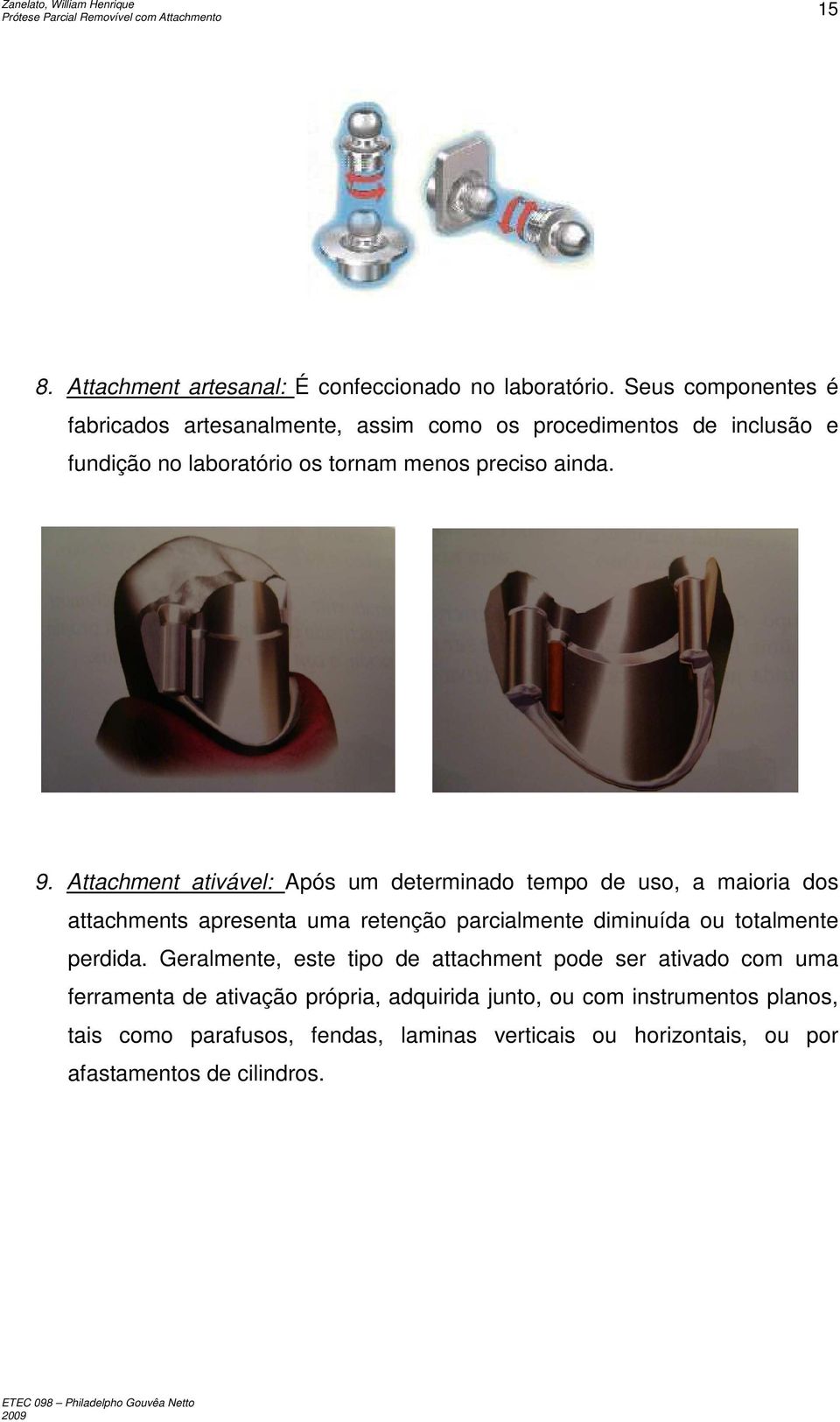 Attachment ativável: Após um determinado tempo de uso, a maioria dos attachments apresenta uma retenção parcialmente diminuída ou totalmente