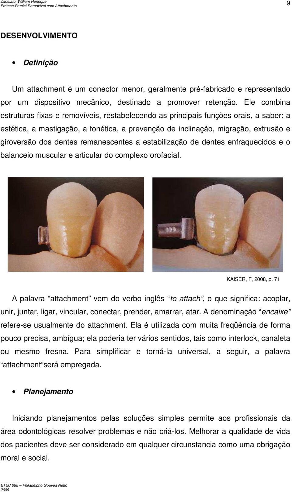 dentes remanescentes a estabilização de dentes enfraquecidos e o balanceio muscular e articular do complexo orofacial. KAISER, F, 2008, p.