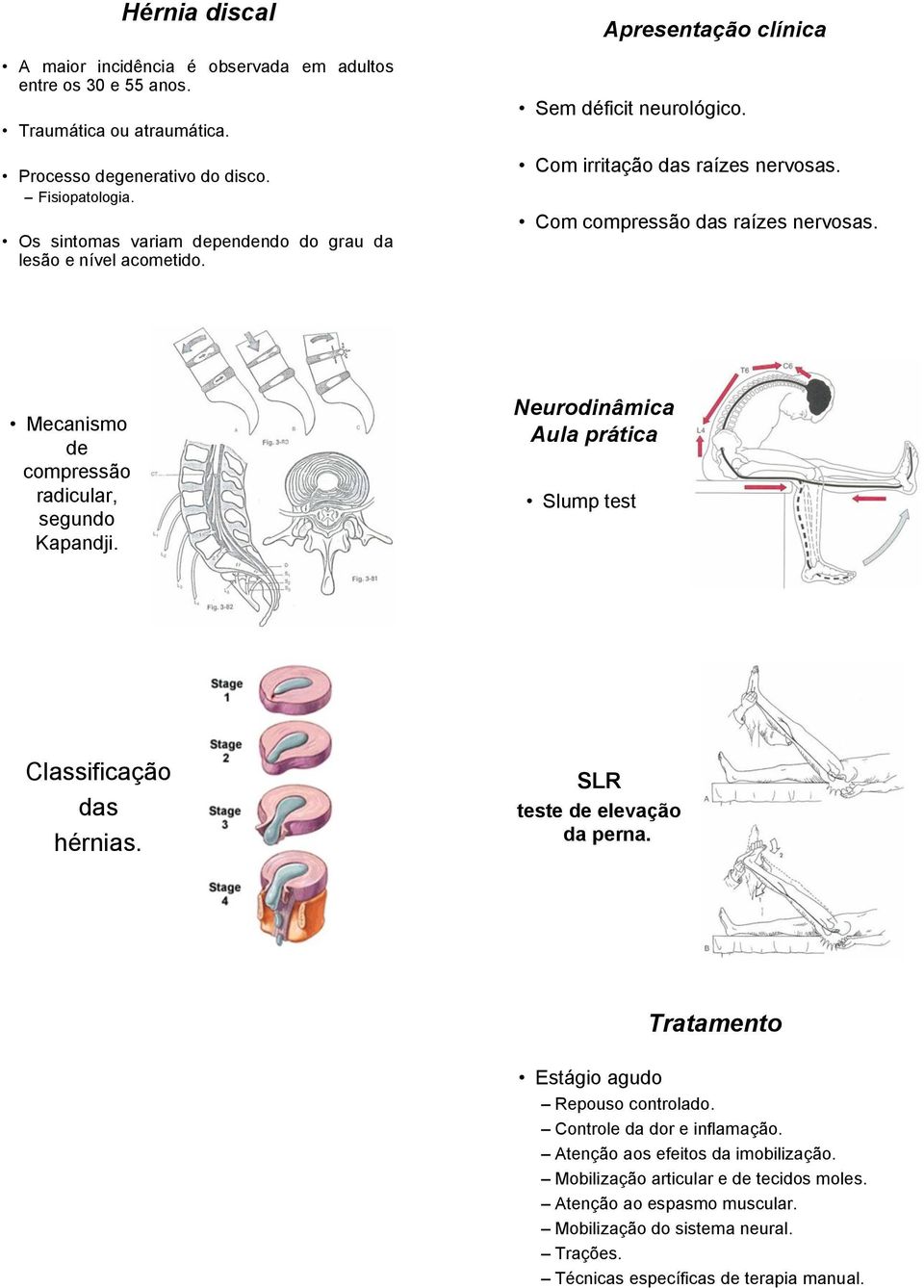 Mecanismo de compressão radicular, segundo Kapandji. Neurodinâmica Aula prática Slump test Classificação das hérnias. SLR teste de elevação da perna.